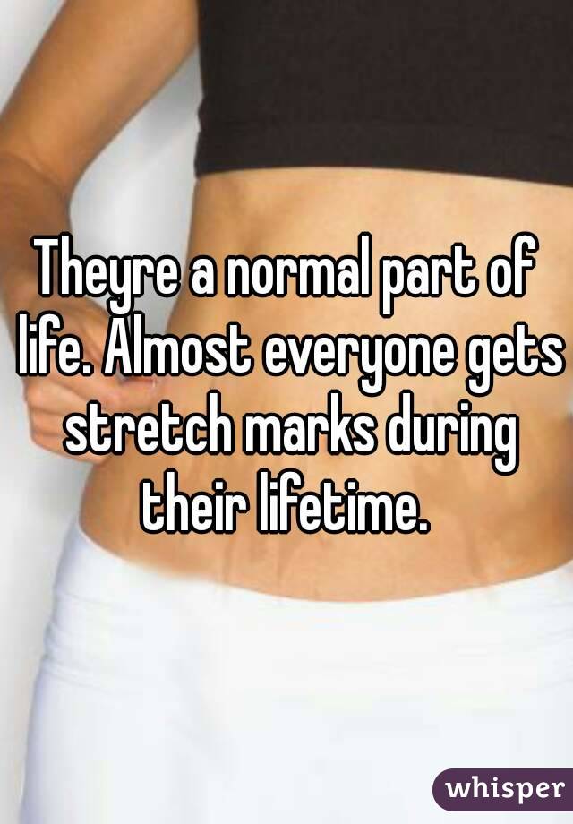 Theyre a normal part of life. Almost everyone gets stretch marks during their lifetime. 