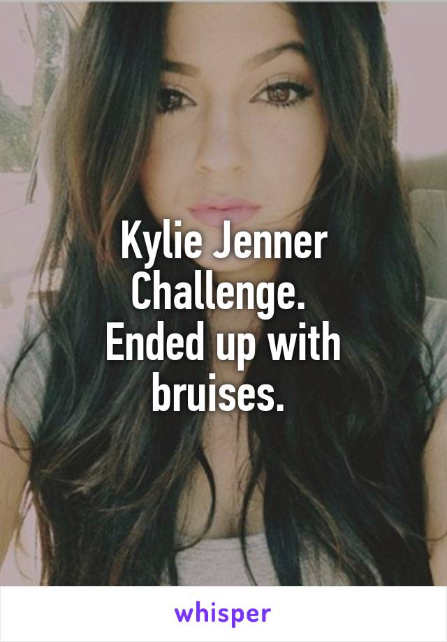 Kylie Jenner Challenge. 
Ended up with bruises. 