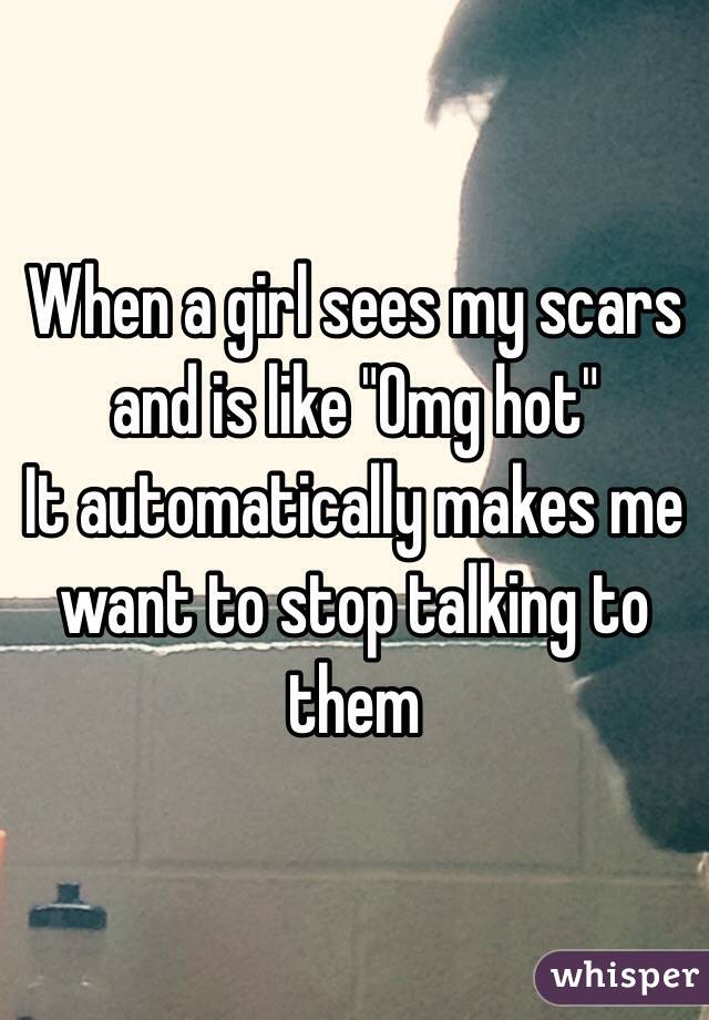 When a girl sees my scars and is like "Omg hot" 
It automatically makes me want to stop talking to them 