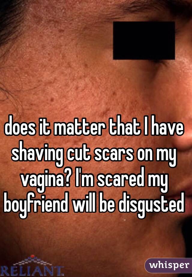 does it matter that I have shaving cut scars on my vagina? I'm scared my boyfriend will be disgusted 