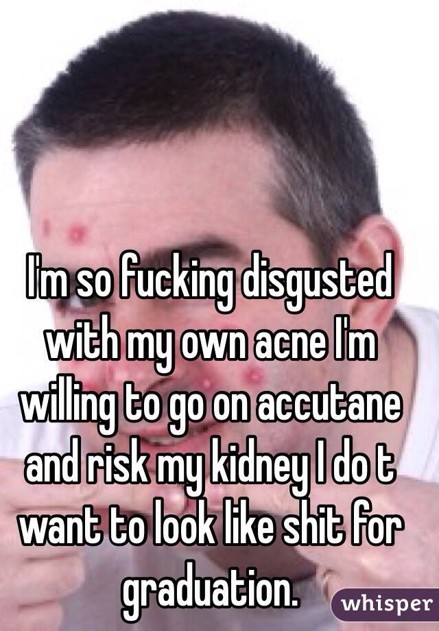 I'm so fucking disgusted with my own acne I'm willing to go on accutane and risk my kidney I do t want to look like shit for graduation.