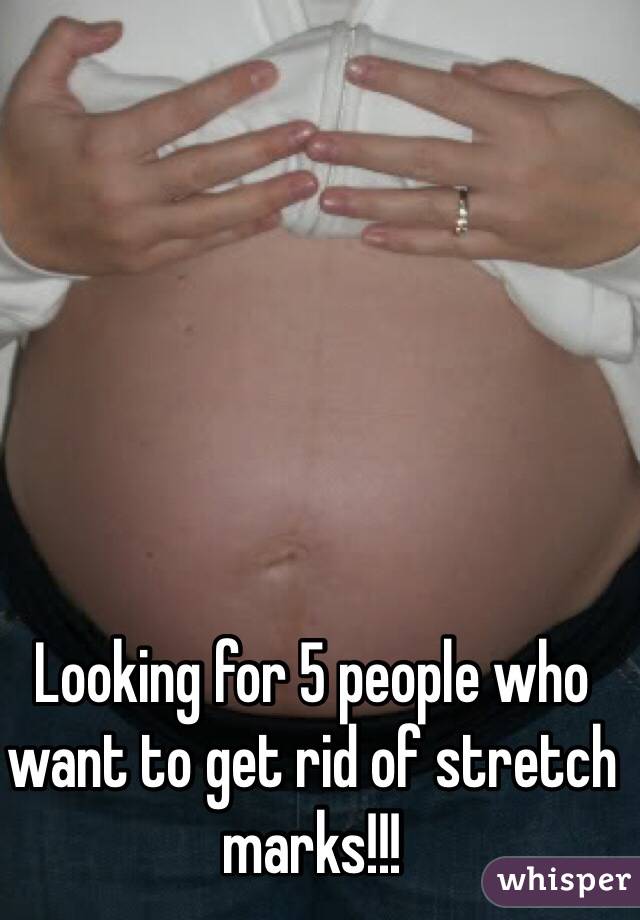 Looking for 5 people who want to get rid of stretch marks!!! 