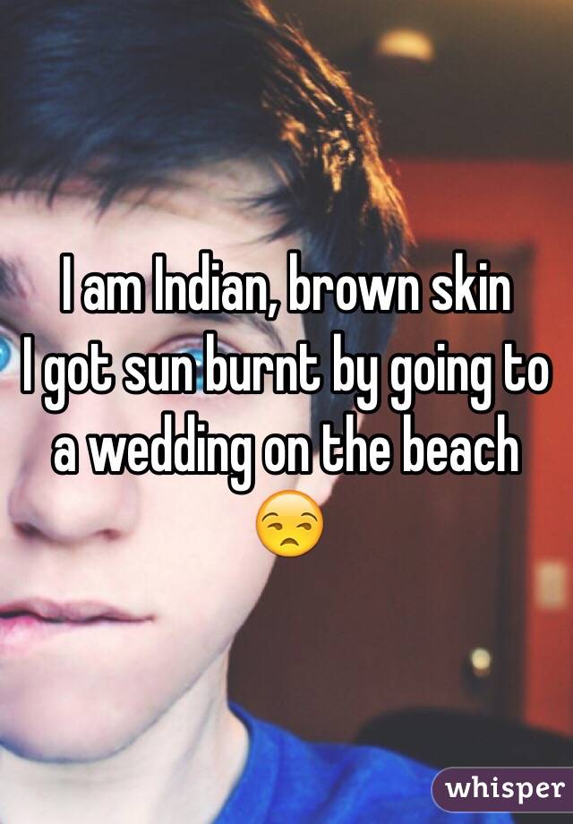 I am Indian, brown skin
I got sun burnt by going to a wedding on the beach 😒 