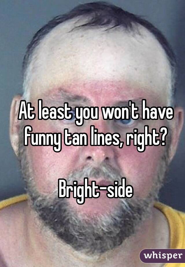 At least you won't have funny tan lines, right?

Bright-side