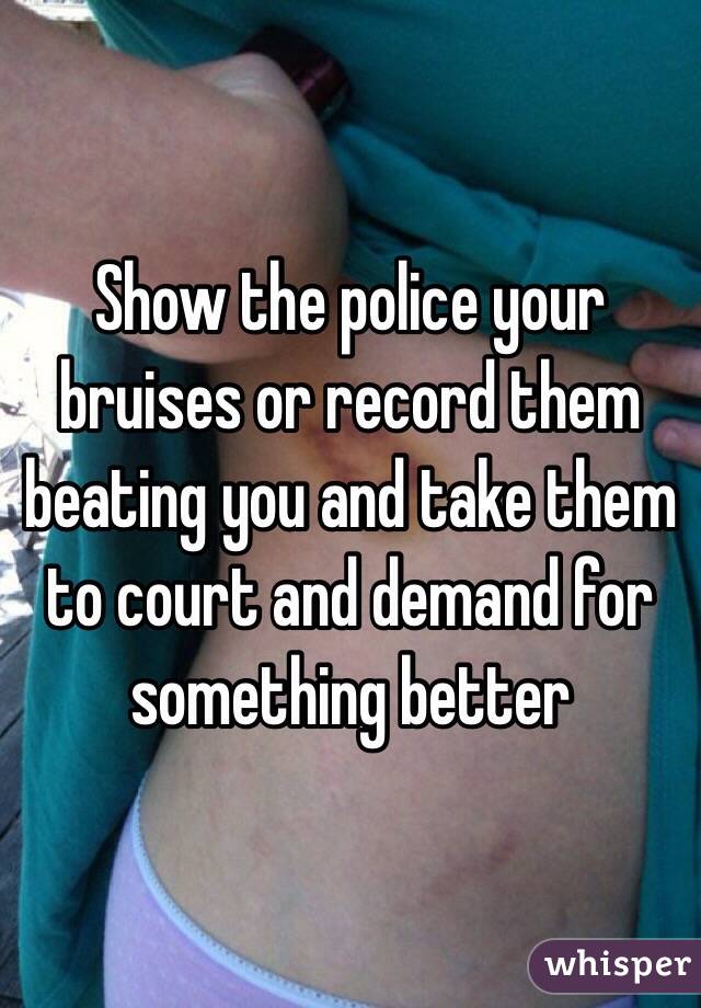 Show the police your bruises or record them beating you and take them to court and demand for something better