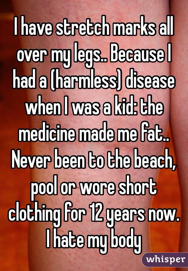 I have stretch marks all over my legs.. Because I had a (harmless) disease when I was a kid: the medicine made me fat..
Never been to the beach, pool or wore short clothing for 12 years now.        I hate my body