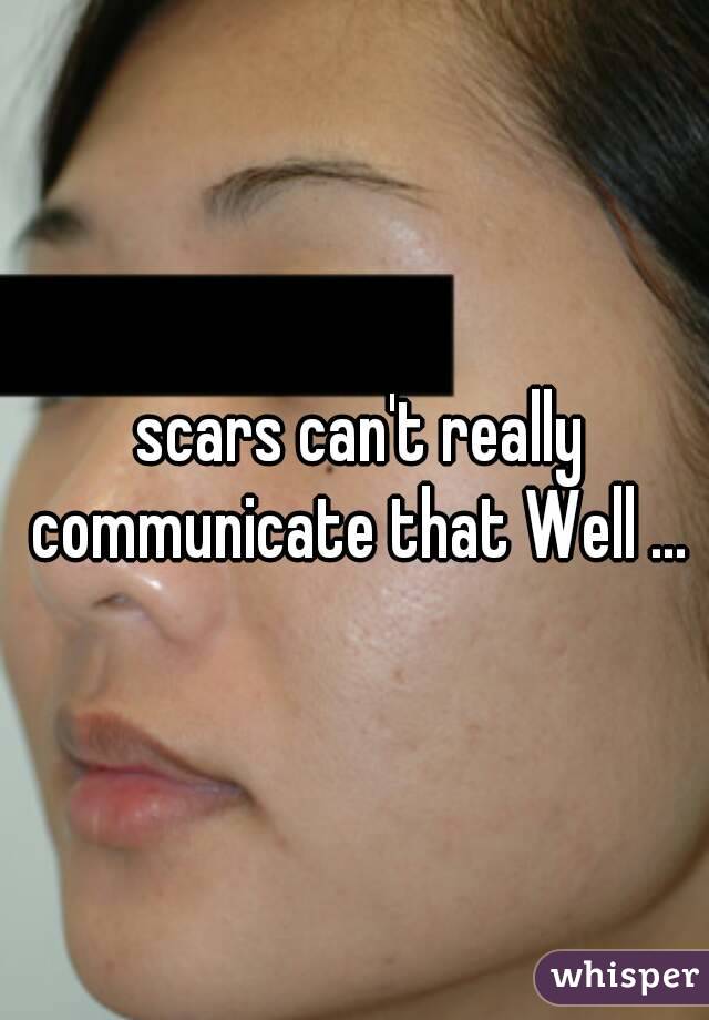  scars can't really communicate that Well ...