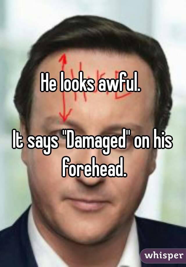 He looks awful. 

It says "Damaged" on his forehead.