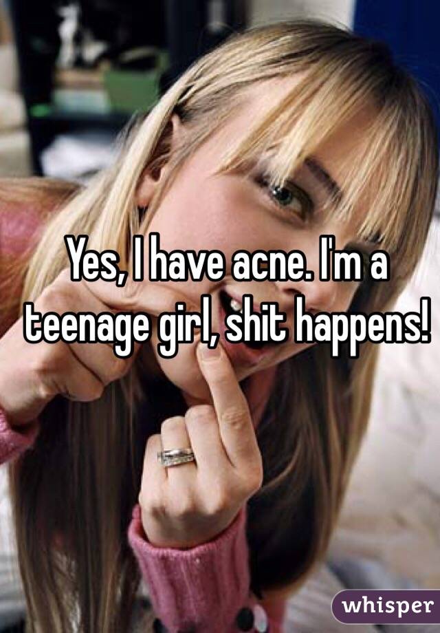 Yes, I have acne. I'm a teenage girl, shit happens!