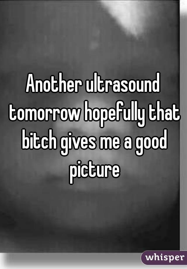 Another ultrasound tomorrow hopefully that bitch gives me a good picture