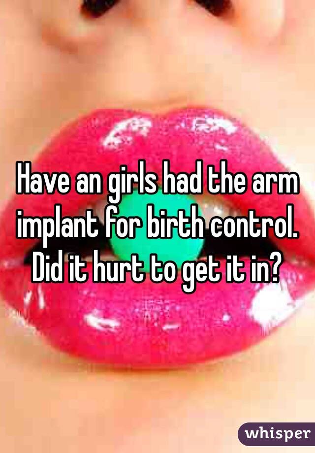 Have an girls had the arm implant for birth control. Did it hurt to get it in? 