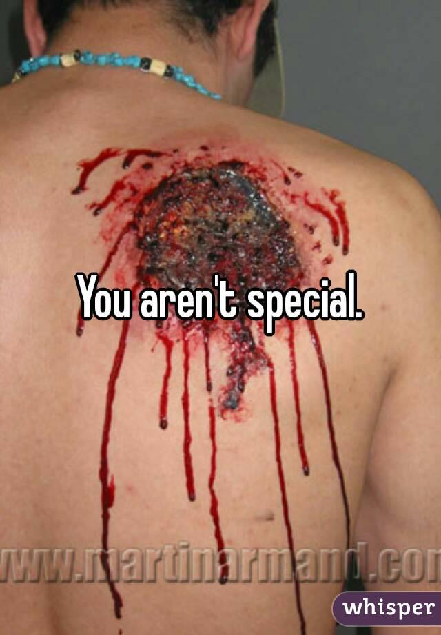 You aren't special.