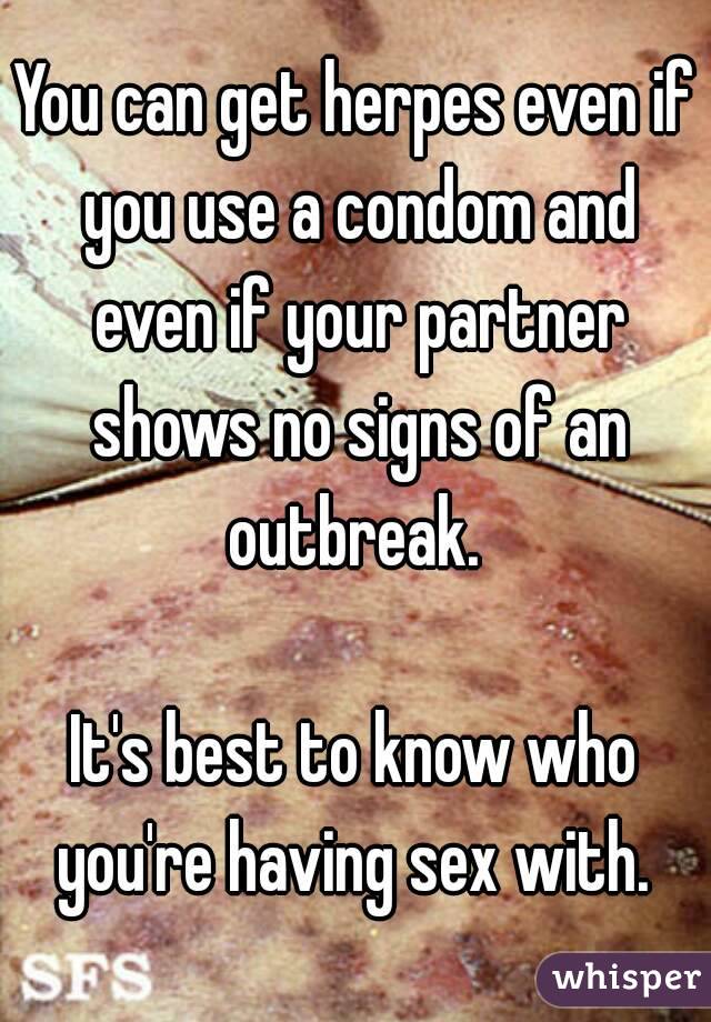 You can get herpes even if you use a condom and even if your partner shows no signs of an outbreak. 

It's best to know who you're having sex with. 