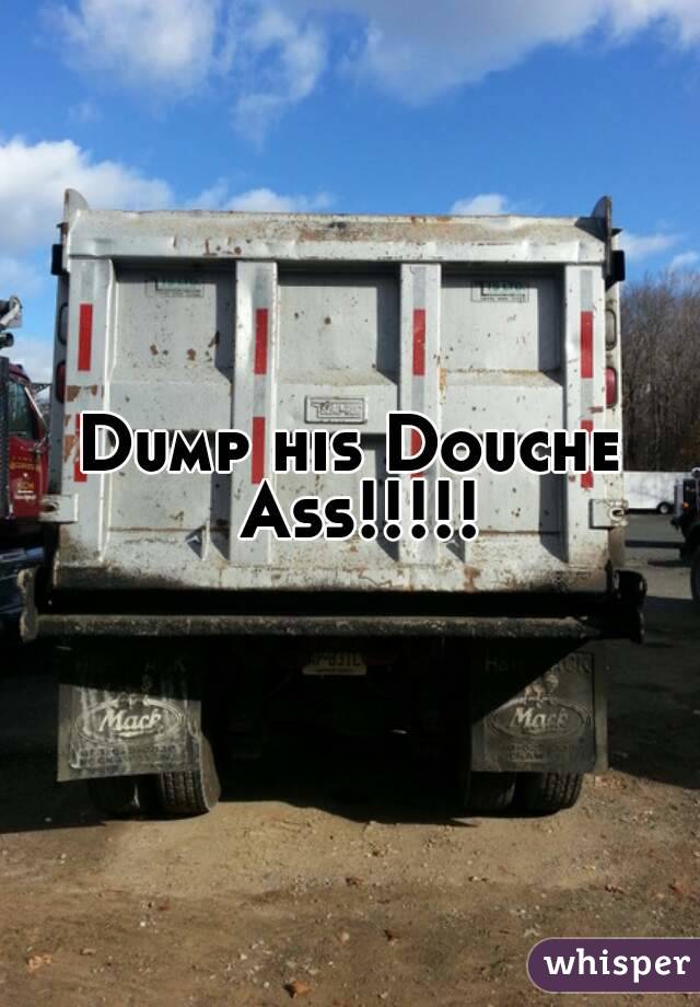 Dump his Douche Ass!!!!!