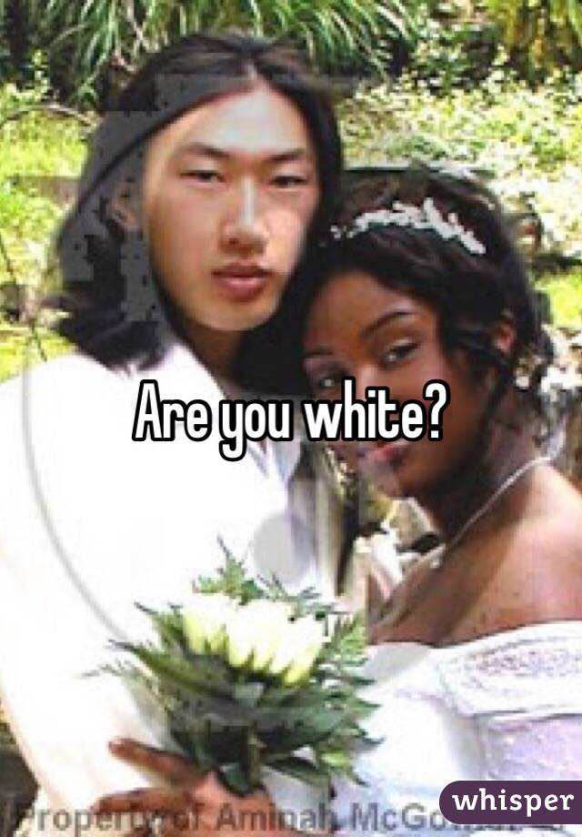 Are you white?