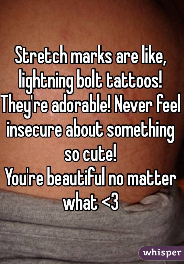 Stretch marks are like, lightning bolt tattoos! They're adorable! Never feel insecure about something so cute! 
You're beautiful no matter what <3
