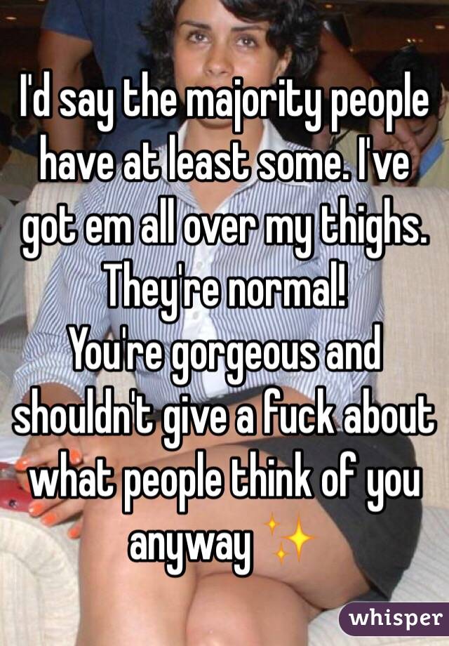 I'd say the majority people have at least some. I've got em all over my thighs. They're normal! 
You're gorgeous and shouldn't give a fuck about what people think of you anyway ✨