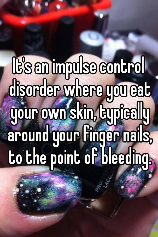 it-s-an-impulse-control-disorder-where-you-eat-your-own-skin-typically