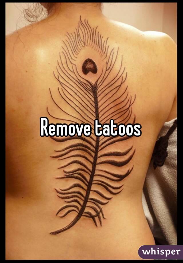 Remove tatoos