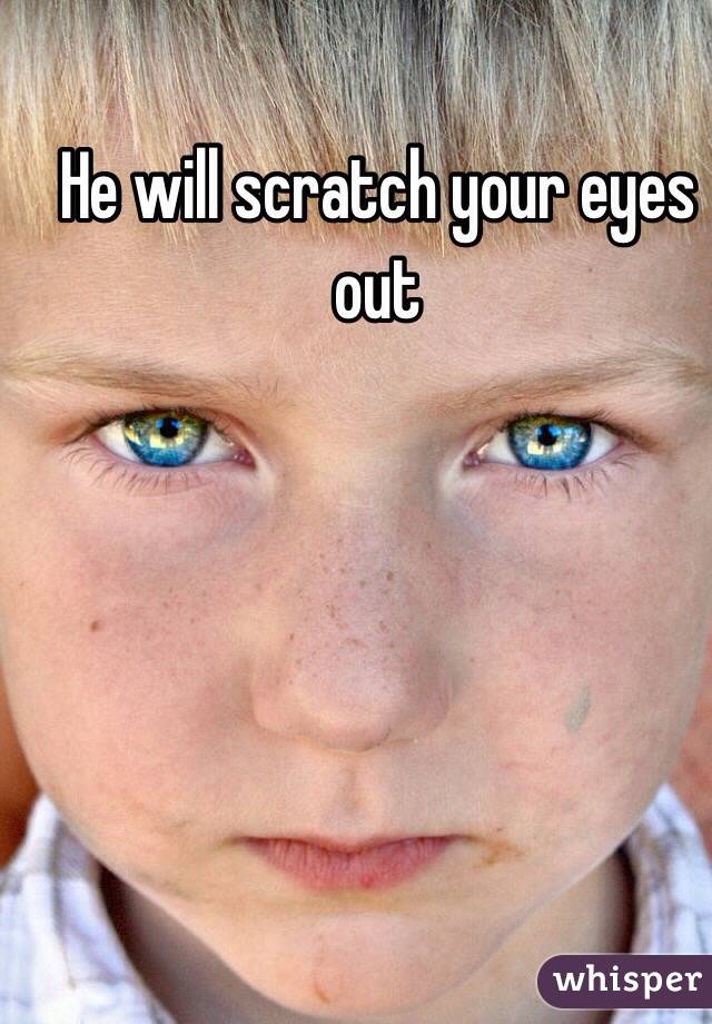 He will scratch your eyes out