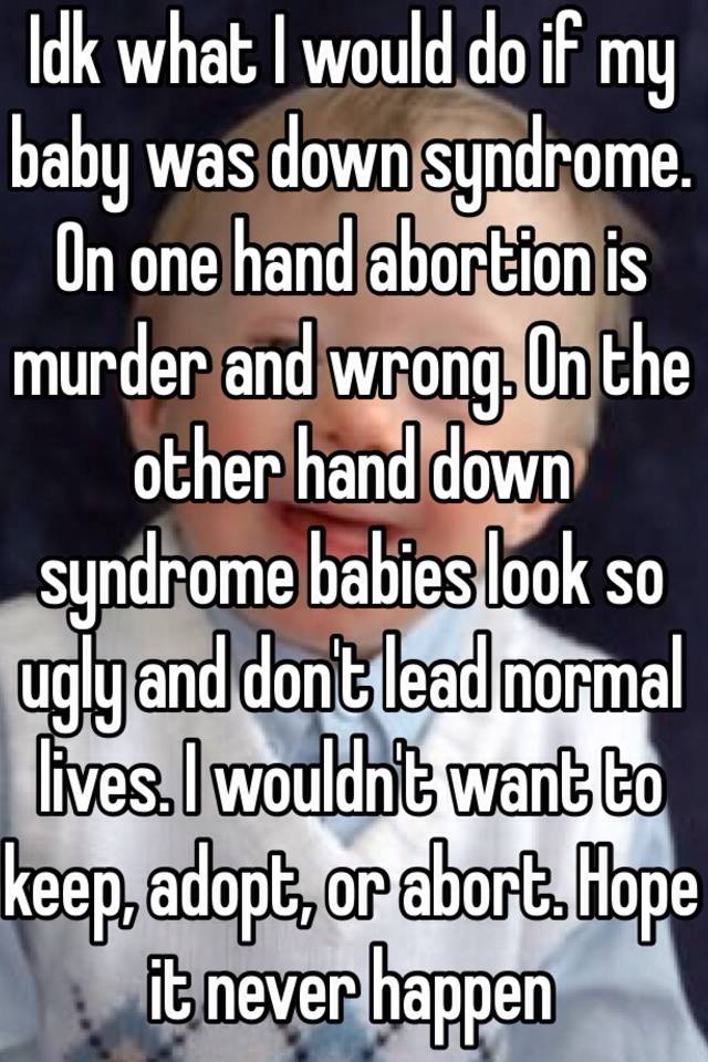 Idk what I would do if my baby was down syndrome. On one hand abortion is murder and wrong. On the other hand down syndrome babies look so ugly and don't lead normal lives. I wouldn't want to keep, adopt, or abort. Hope it never happen