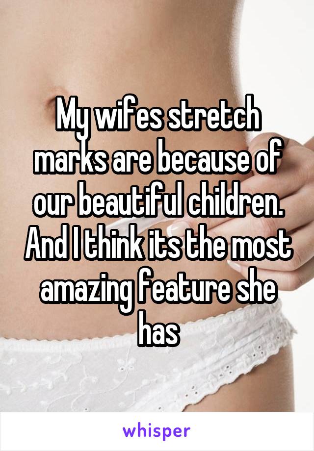 My wifes stretch marks are because of our beautiful children. And I think its the most amazing feature she has