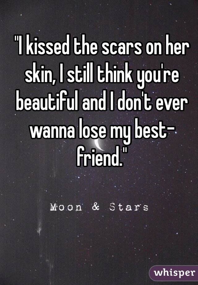 "I kissed the scars on her skin, I still think you're beautiful and I don't ever wanna lose my best-friend."