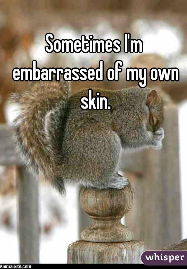 Sometimes I'm embarrassed of my own skin.