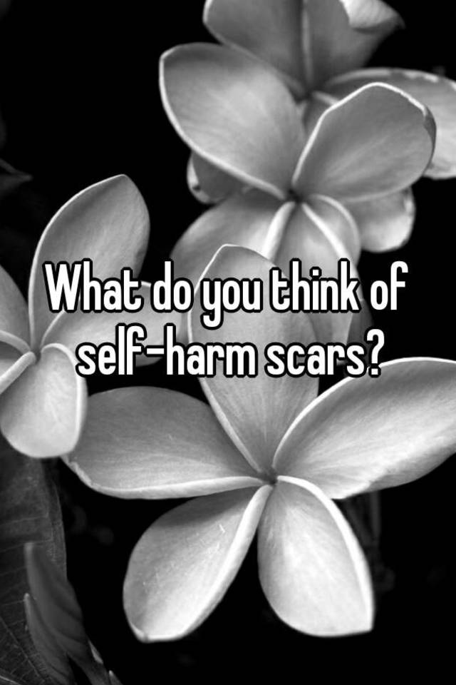 can-you-make-scars-go-away-sharecare