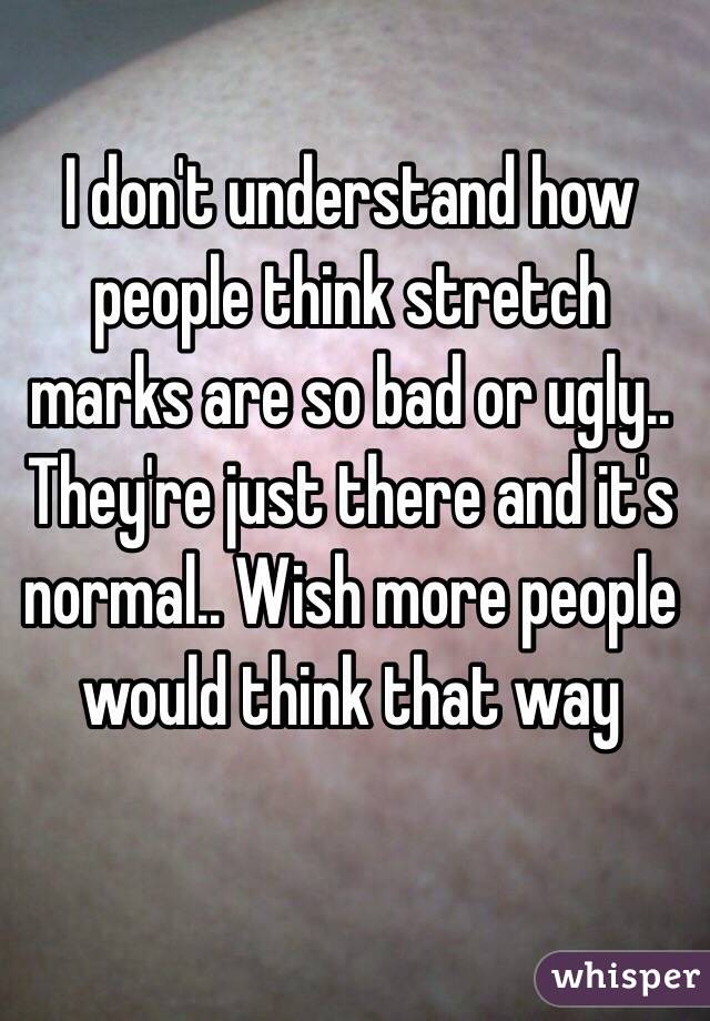 I don't understand how people think stretch marks are so bad or ugly.. They're just there and it's normal.. Wish more people would think that way