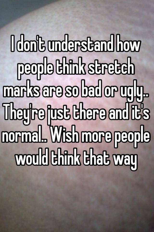 I don't understand how people think stretch marks are so bad or ugly.. They're just there and it's normal.. Wish more people would think that way