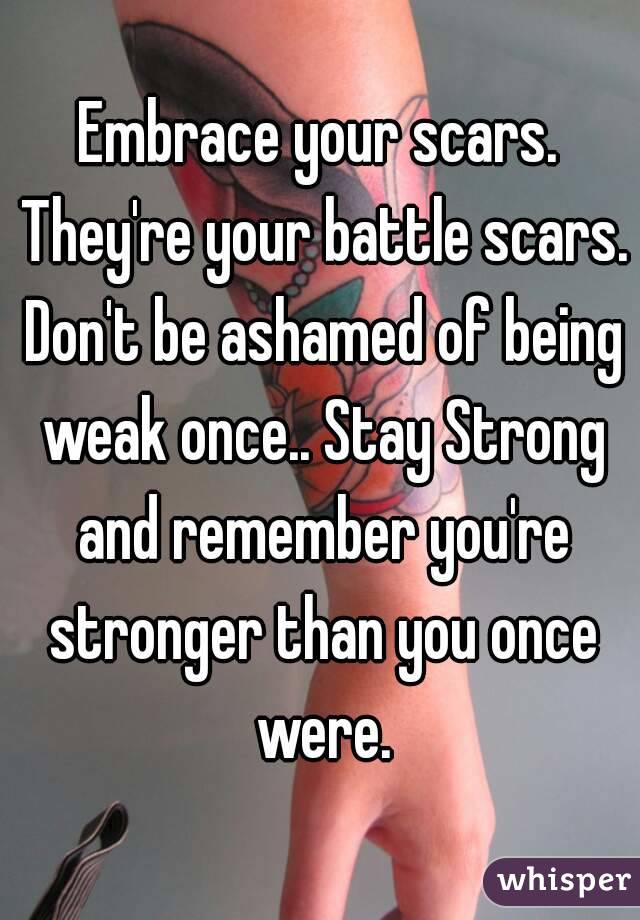 Embrace your scars. They're your battle scars. Don't be ashamed of being weak once.. Stay Strong and remember you're stronger than you once were.