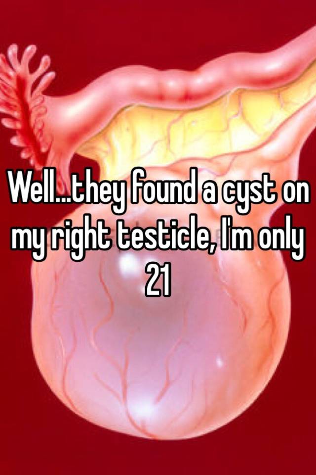 Well They Found A Cyst On My Right Testicle I M Only 21