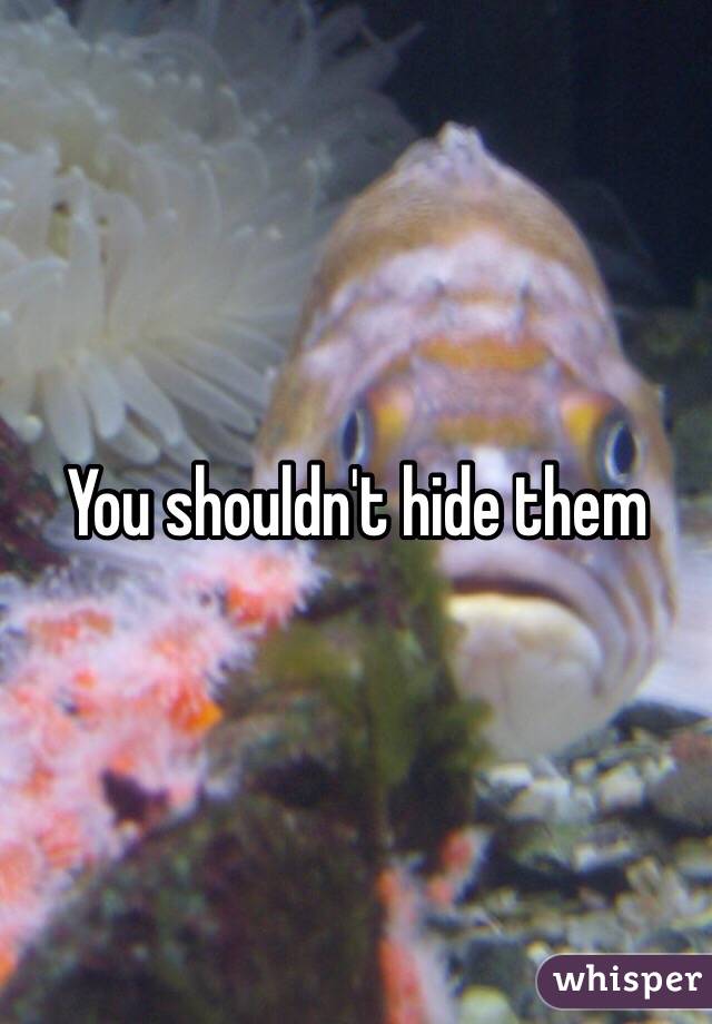 You shouldn't hide them 