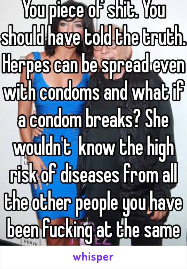 You piece of shit. You should have told the truth. Herpes can be spread even with condoms and what if a condom breaks? She wouldn't  know the high risk of diseases from all the other people you have been fucking at the same time. 