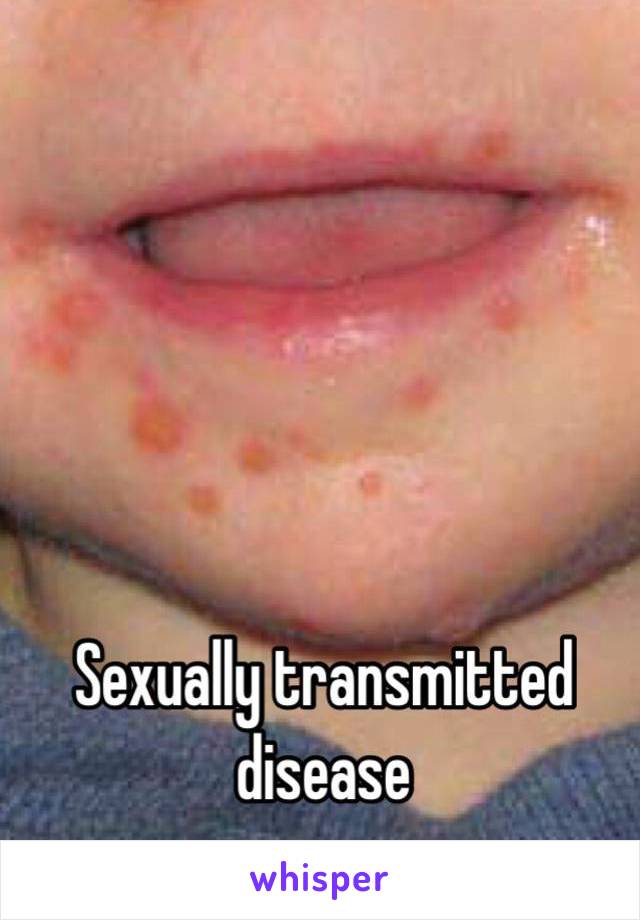 Sexually transmitted disease