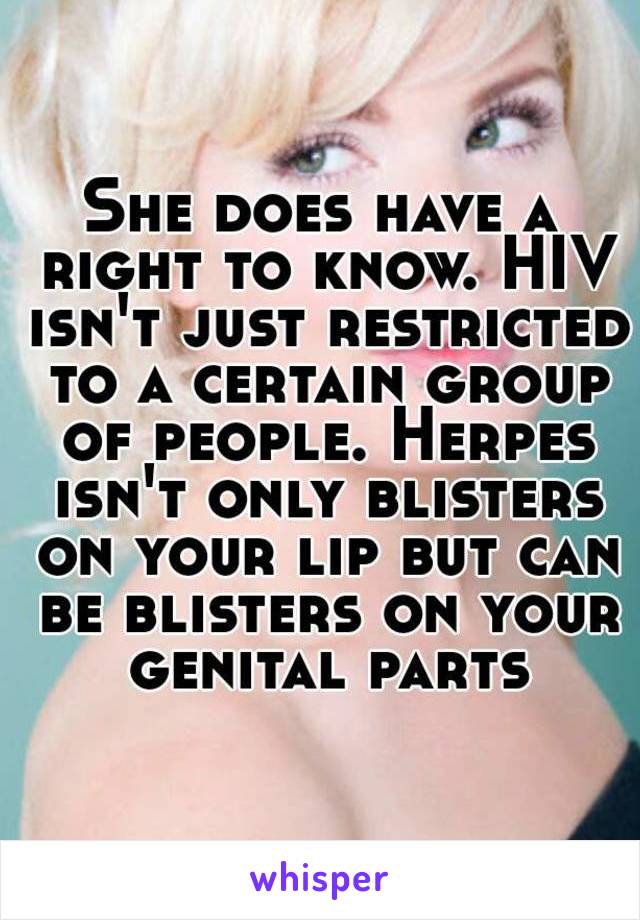 She does have a right to know. HIV isn't just restricted to a certain group of people. Herpes isn't only blisters on your lip but can be blisters on your genital parts