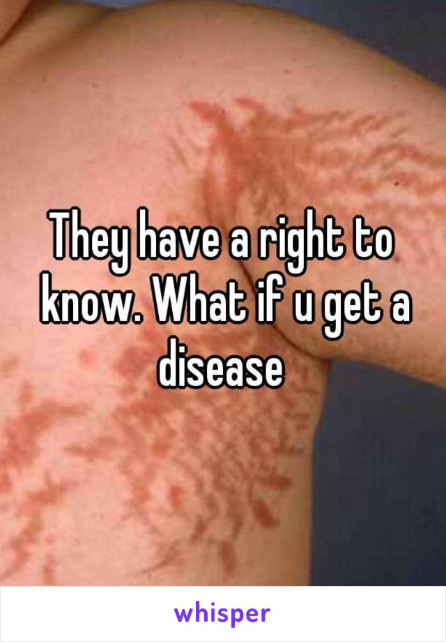 They have a right to know. What if u get a disease 