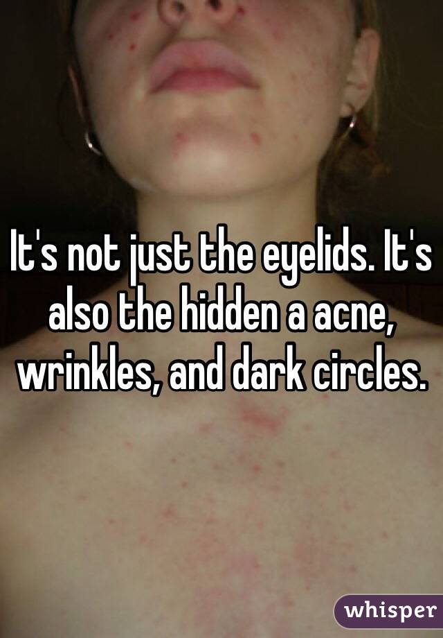 It's not just the eyelids. It's also the hidden a acne, wrinkles, and dark circles. 