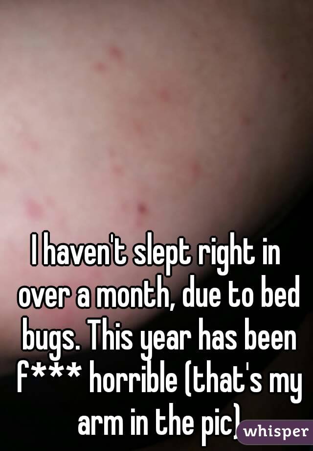 I haven't slept right in over a month, due to bed bugs. This year has been f*** horrible (that's my arm in the pic)