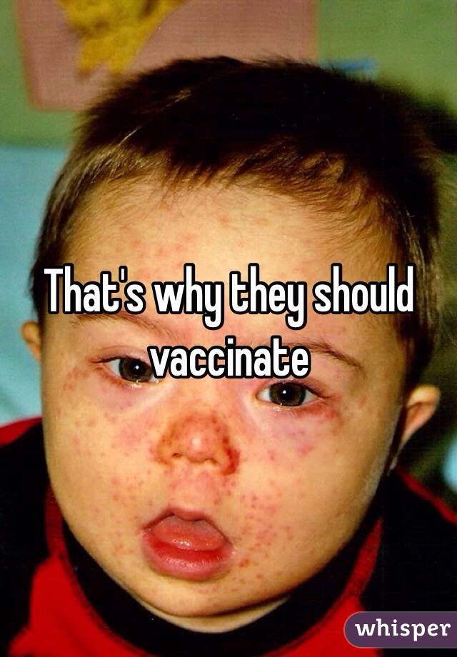 That's why they should vaccinate 