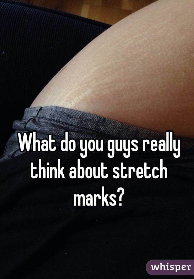 What do you guys really think about stretch marks?
