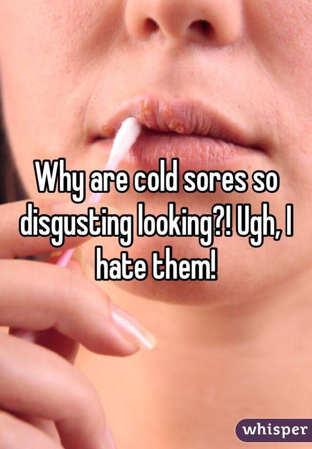 Why are cold sores so disgusting looking?! Ugh, I hate them!