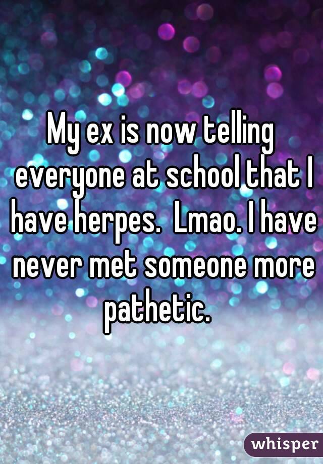 My ex is now telling everyone at school that I have herpes.  Lmao. I have never met someone more pathetic.  
