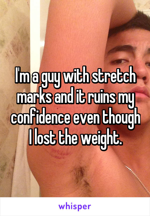 I'm a guy with stretch marks and it ruins my confidence even though I lost the weight.