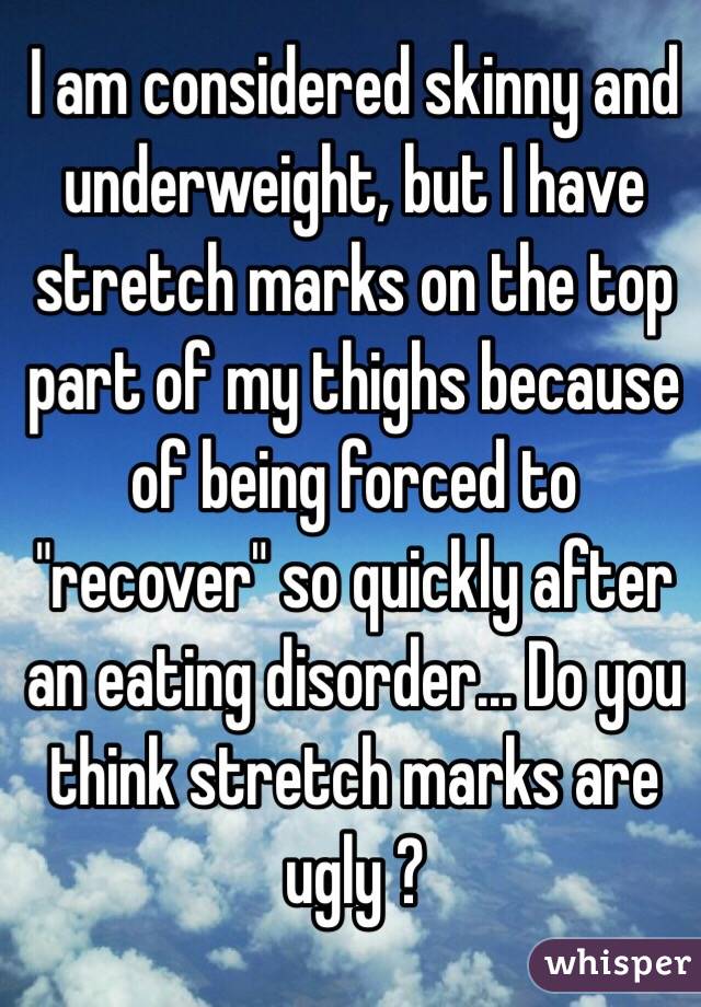 I am considered skinny and underweight, but I have stretch marks on the top part of my thighs because of being forced to "recover" so quickly after an eating disorder... Do you think stretch marks are ugly ?
