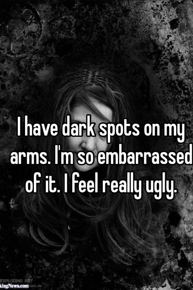 i-have-dark-spots-on-my-arms-i-m-so-embarrassed-of-it-i-feel-really-ugly