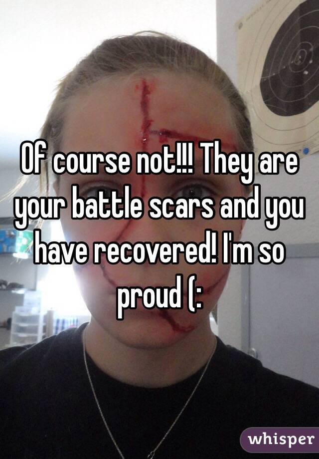 Of course not!!! They are your battle scars and you have recovered! I'm so proud (: