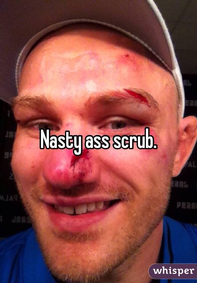 Nasty ass scrub. 