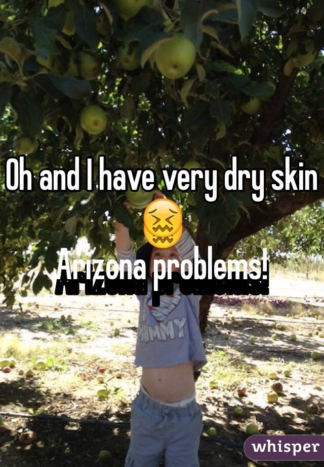 Oh and I have very dry skin
😖
Arizona problems!